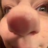 skinscreamk
